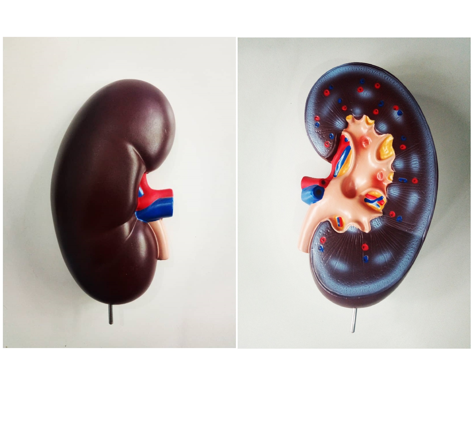 Kidney Model (1 part)